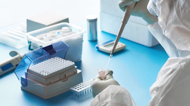 Rapid Antigen PCR Swab