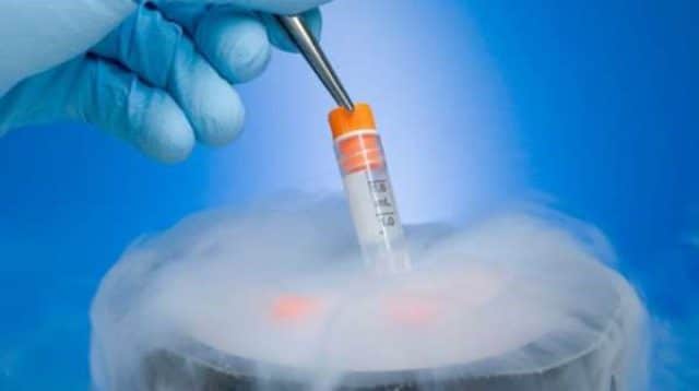 egg freezing