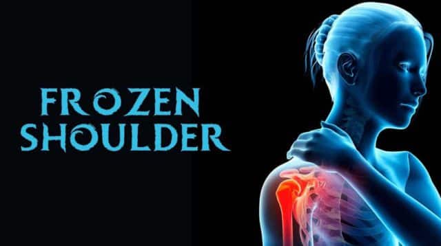 Frozen Shoulder