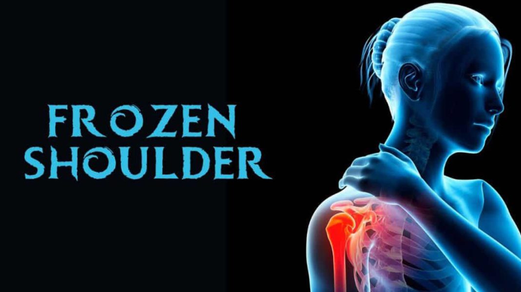 Frozen Shoulder