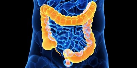 Irritable Bowel Syndrome