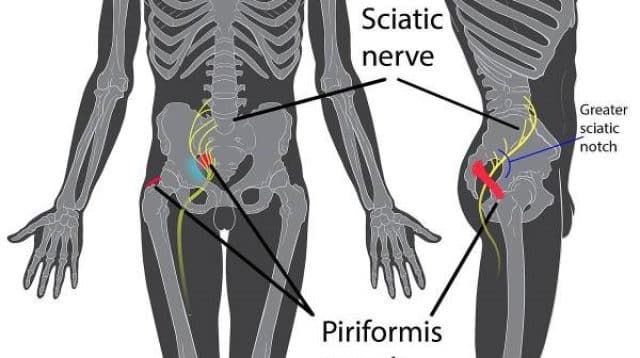 Piriformis