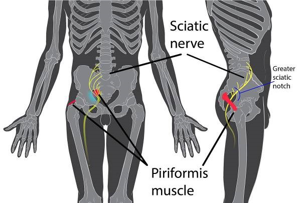 Piriformis