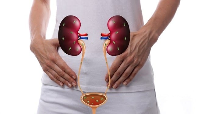 Urinary Tract Infection