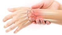 de quervain syndrome
