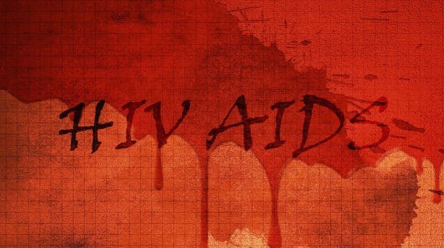 hiv aids