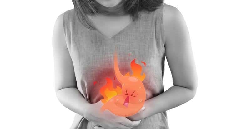 Gastroesophageal reflux disease (GERD)
