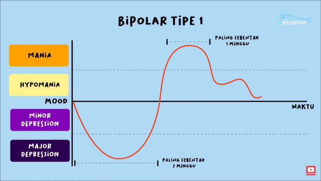 Bipolar tipe 1