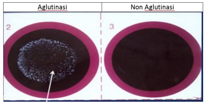 Aglutinasi dan Non Aglutinasi