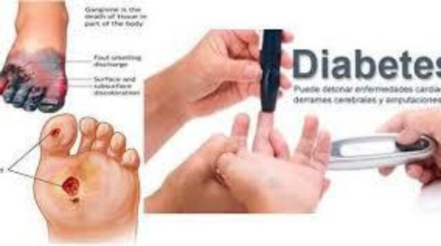 Diabetes