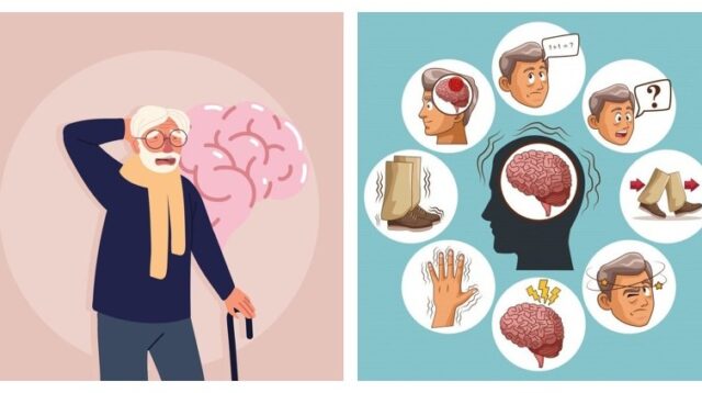 Neurodegenerasi Alzheimer