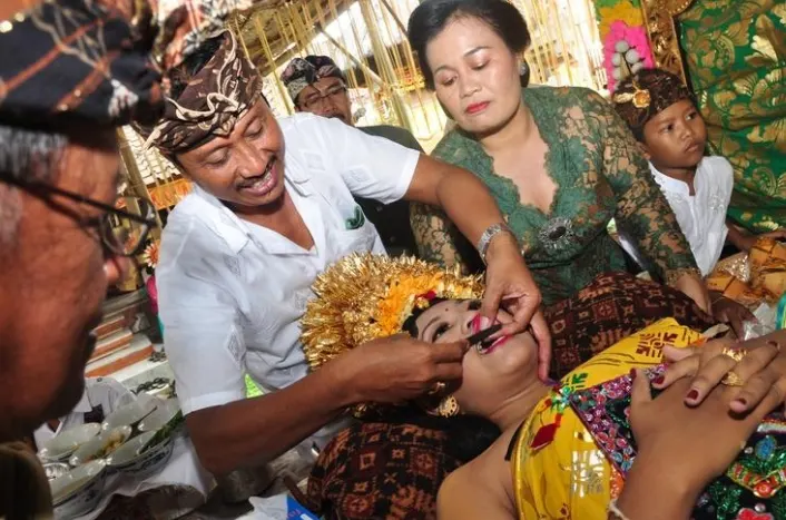 Potong Gigi Tanda Kedewasaan? Tradisi Metatah Bali Miliki Banyak Makna bagi Penduduknya