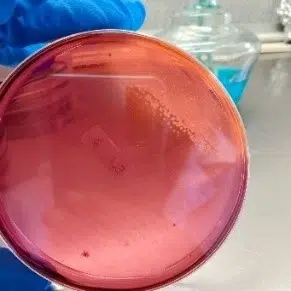 jurnal bakteri escherichia coli