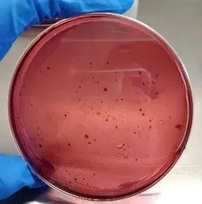 jurnal bakteri escherichia coli