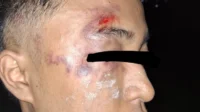 Kader HMI Cabang Pontianak jadi korban represif polisi pada demonstrasi