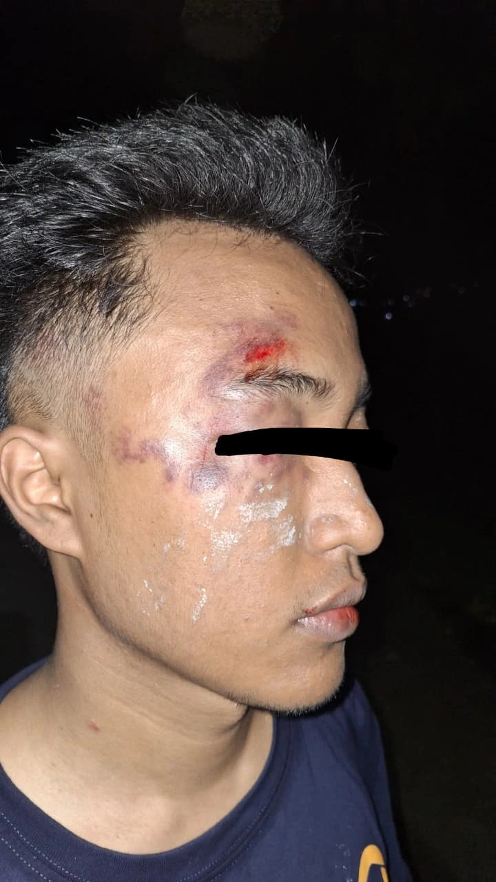 Kader HMI Cabang Pontianak jadi korban represif polisi pada demonstrasi