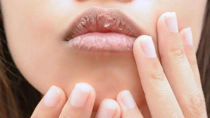 Tips Agar Bibir Tidak Hitam (Cegah dan Atasi Sekarang!)