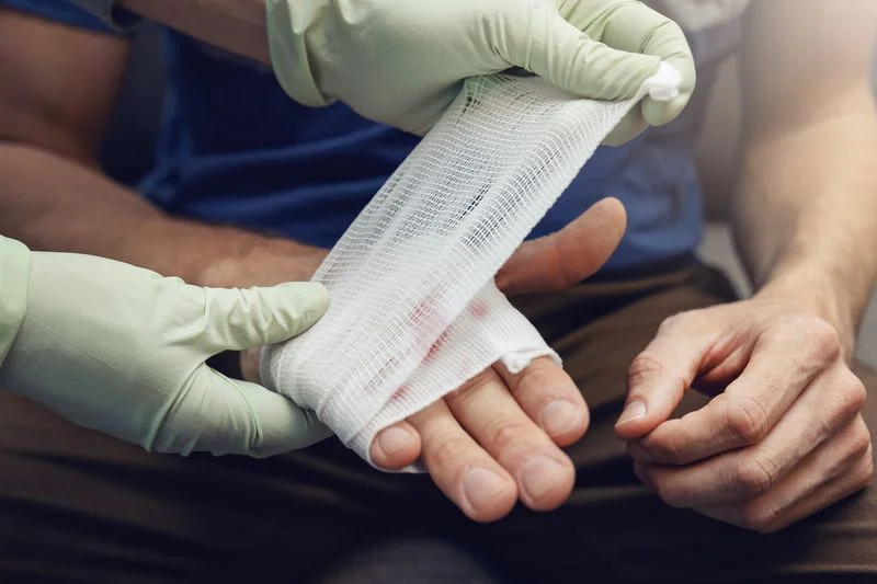 Tips Agar Luka Cepat Kering: Panduan Lengkap Merawat Luka dengan Benar