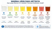 Rahasia di Balik Warna dan Konsistensi Urin: Mengapa Urin Bisa Pekat dan Encer? warna urin