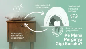 Gigi Susu